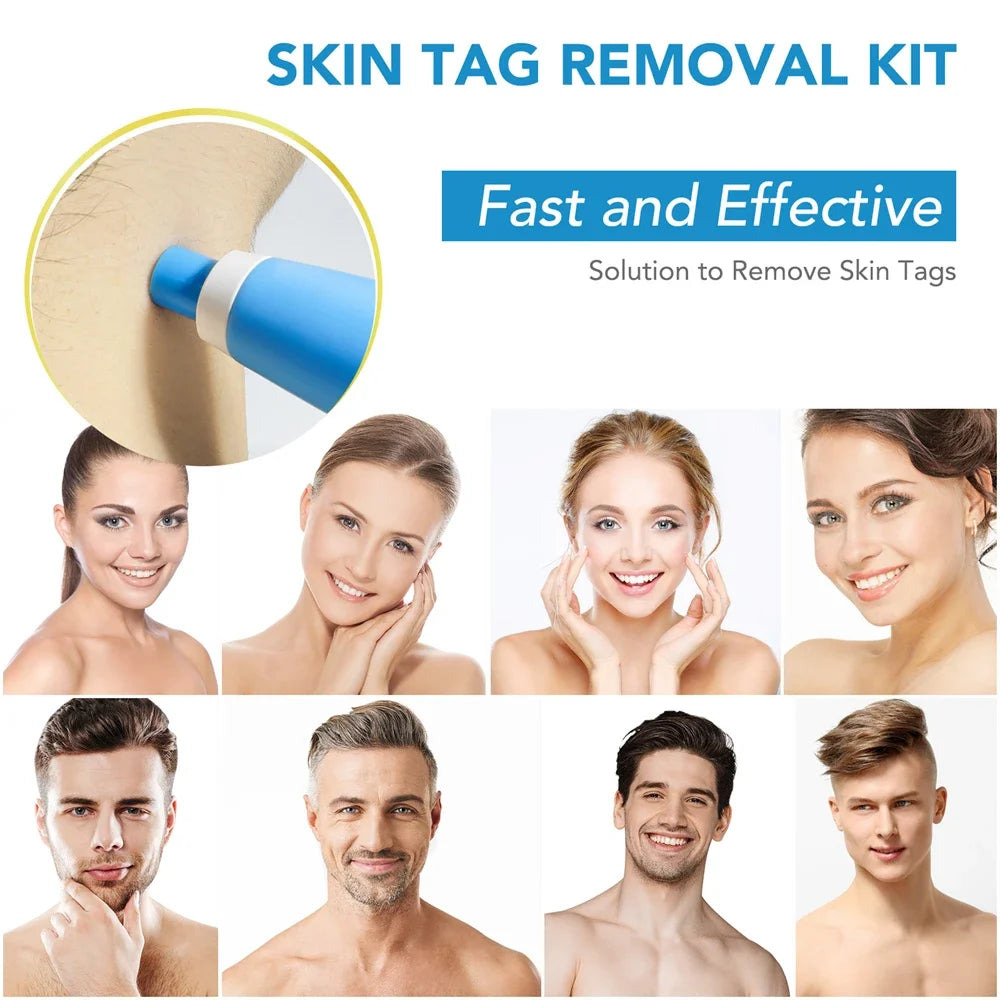 2-in-1 Skin Tag & Mole Remover Kit