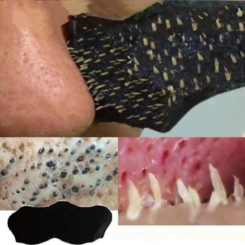 Unisex Blackhead Remove Mask Nasal Strips