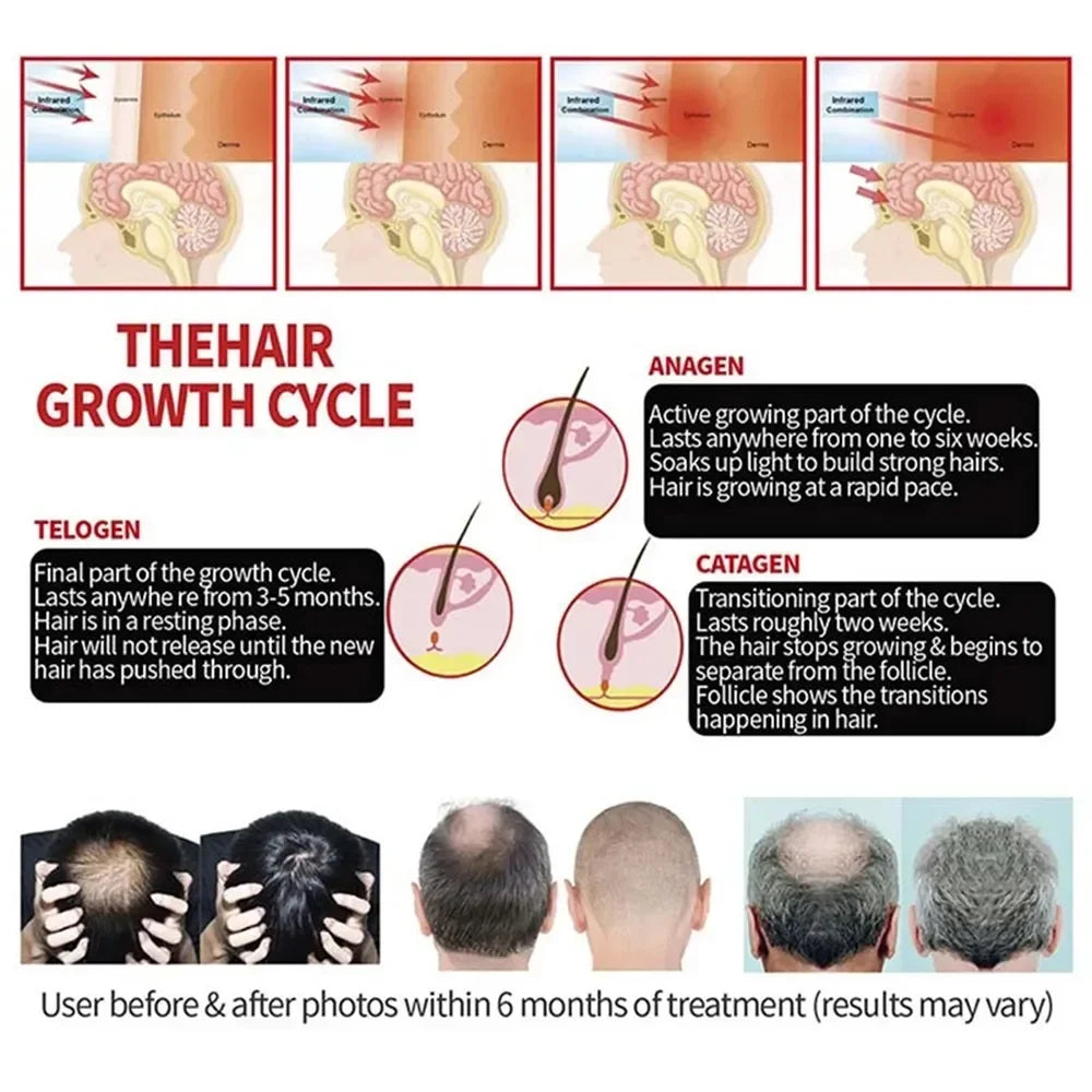 Red Light Therapy Hat For Hair Growth