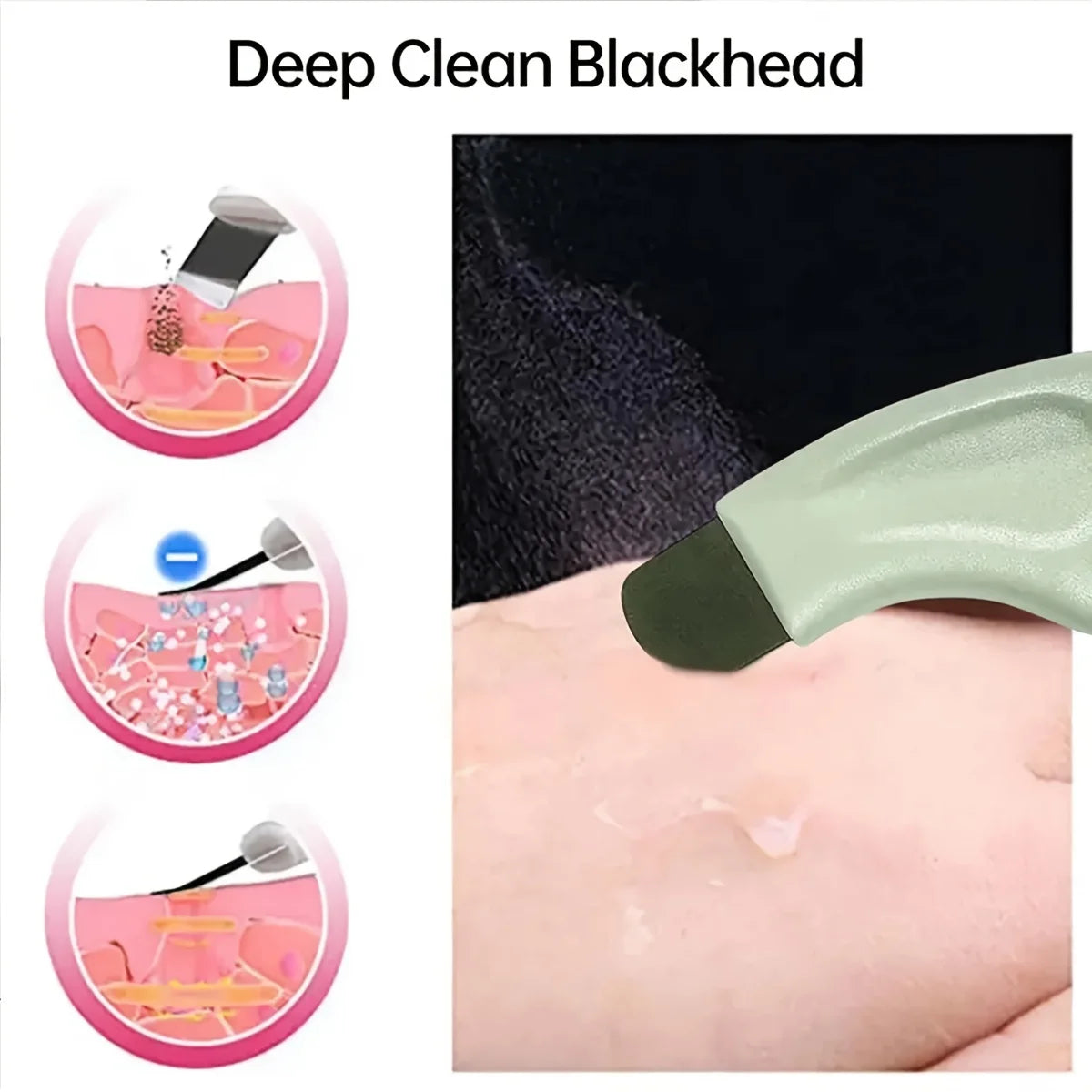 Facial Blackhead Removal