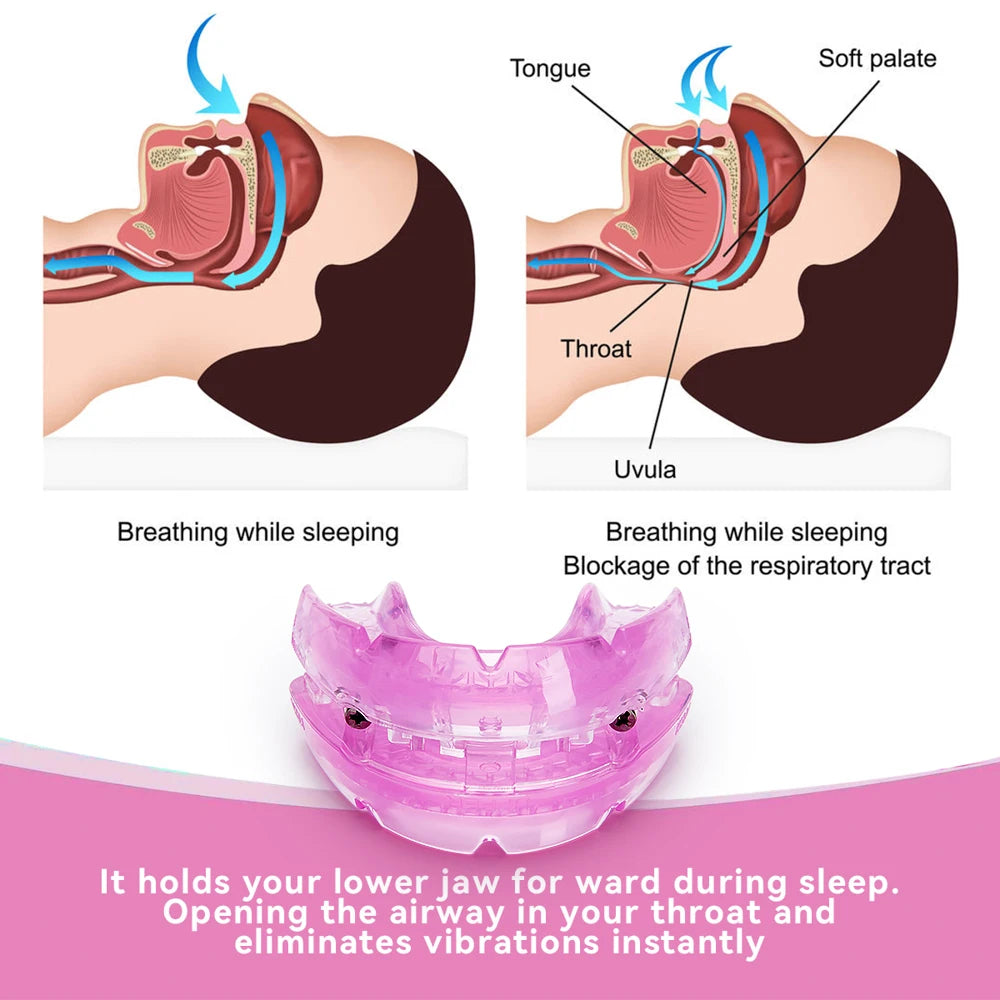 Adjustable Anti-Snoring Mouthpiece